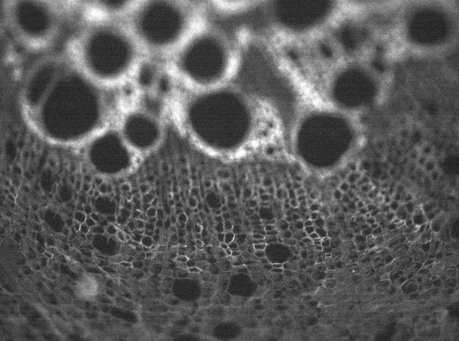 A thin section of tissue with large round vessels above a field of small cells. The small cells are sharp; the walls around the large vessels are blurred.